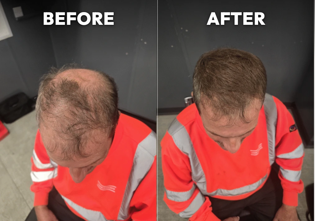 Densifol coverage, without and with
