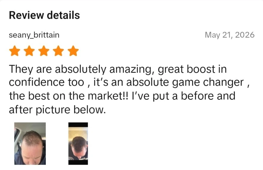 Verified Densifol customer review with before and after
