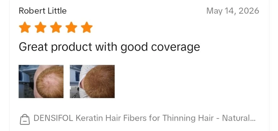 Verified Densifol customer review with before and after