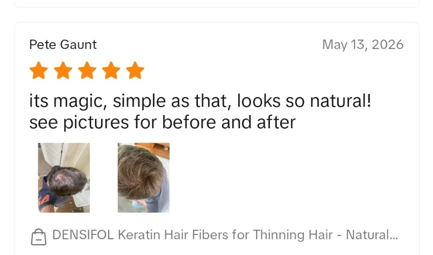 Verified Densifol customer review with before and after