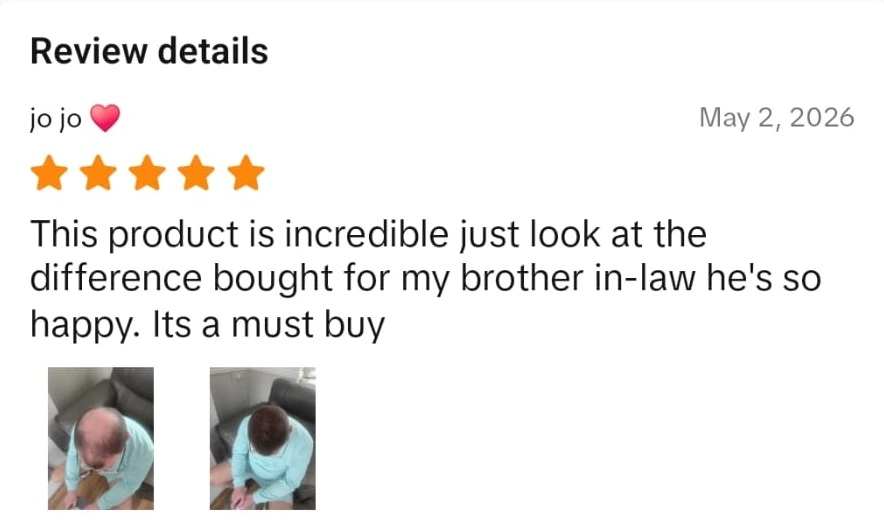 Verified Densifol customer review with before and after